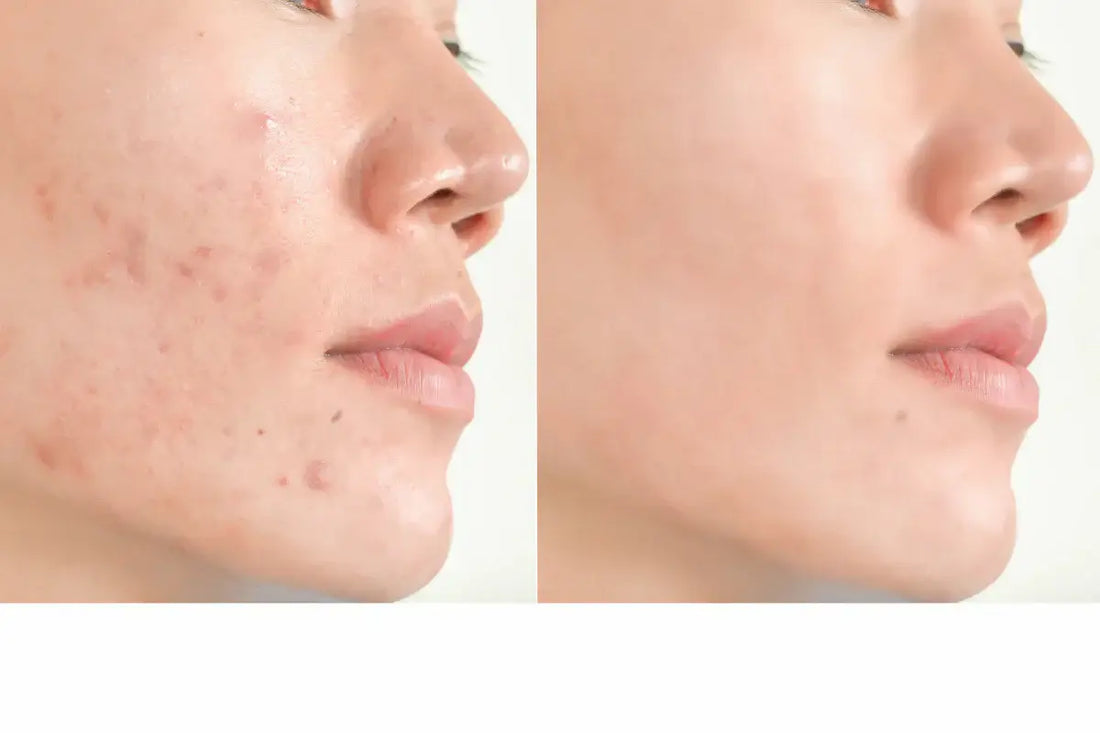 💧K-Beauty & the Skin Barrier: The Secret to Strong, Glowing Skin