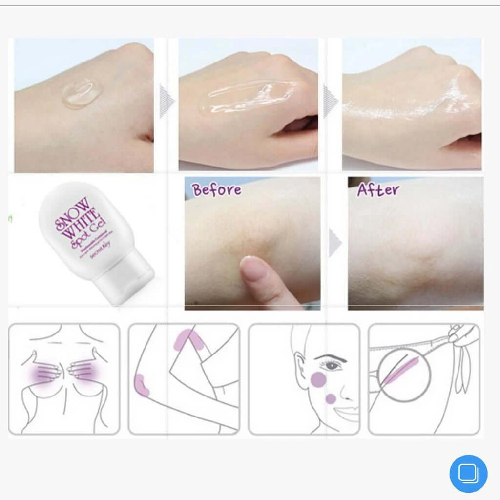 Before and after using Secret Key Snow White Spot Gel on dark skin areas, showing smooth and brightened skin.
